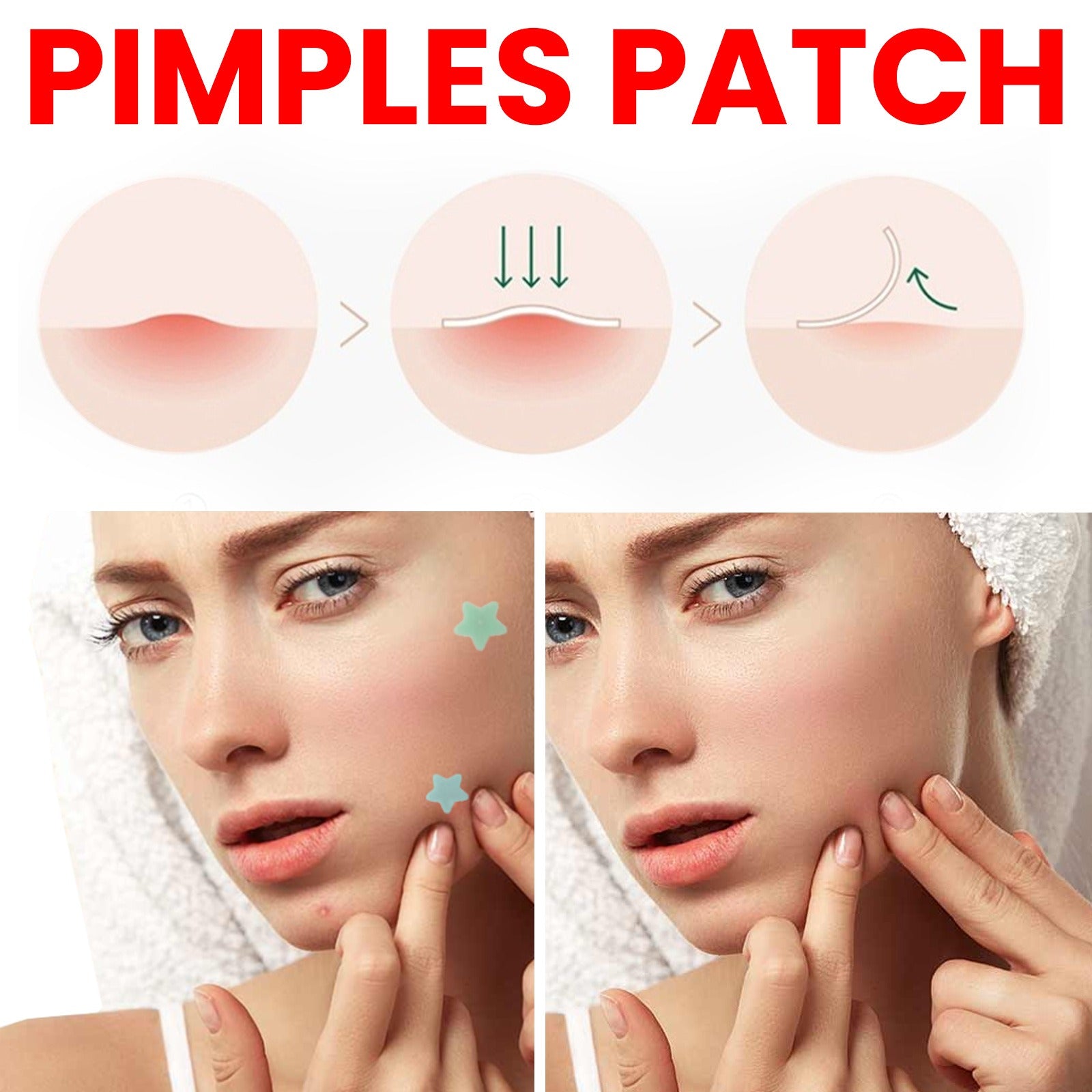 JaysuingRepair Acne Patch Facial Skin Care Fade Blemishes Pimple Marks Closed Acne Blemishes Cover Acne Pimple Repair Patch